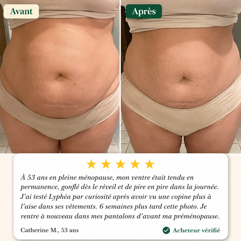 Antes / Después