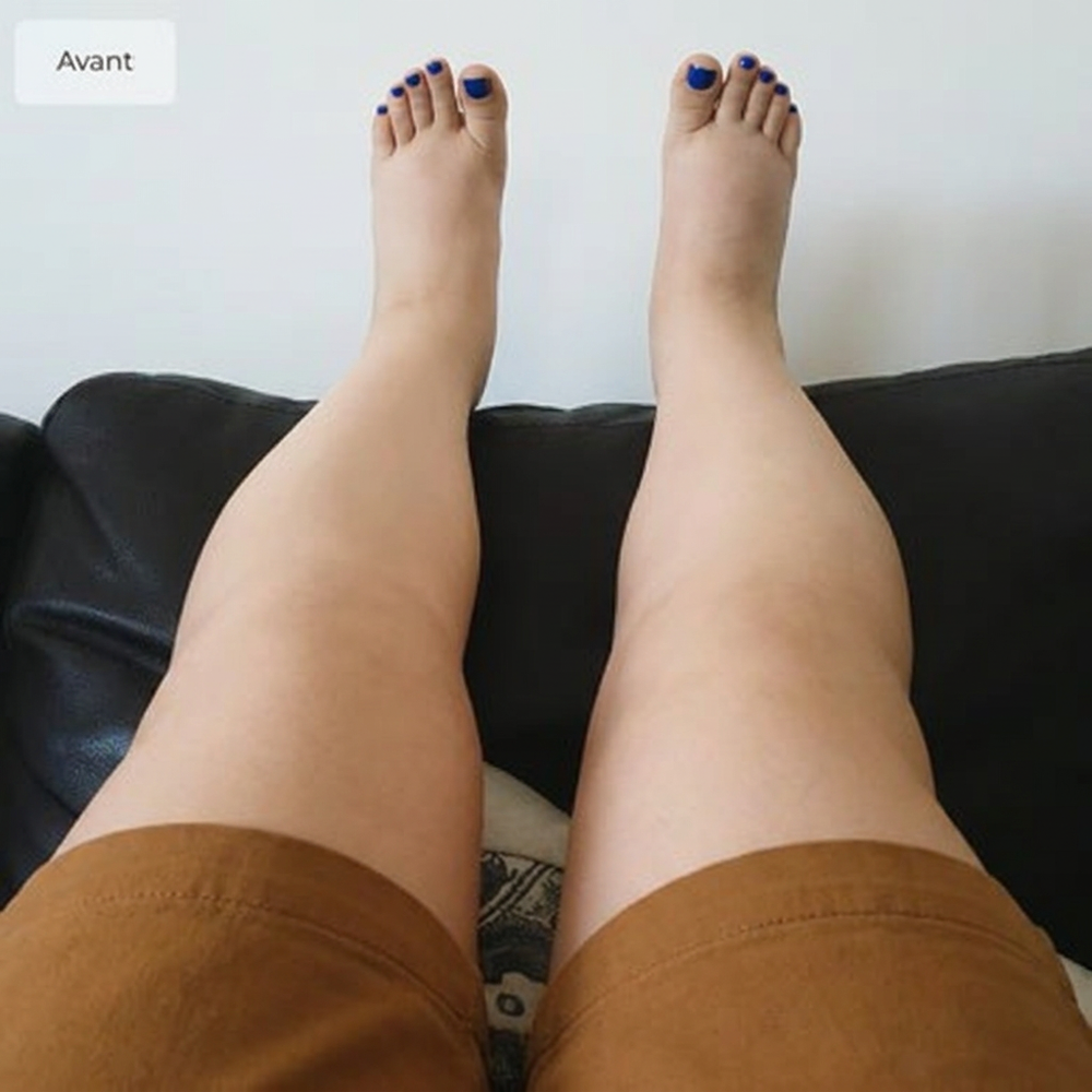 Before comparison photo